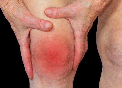 What is arthritis? What are its causes and symptoms?